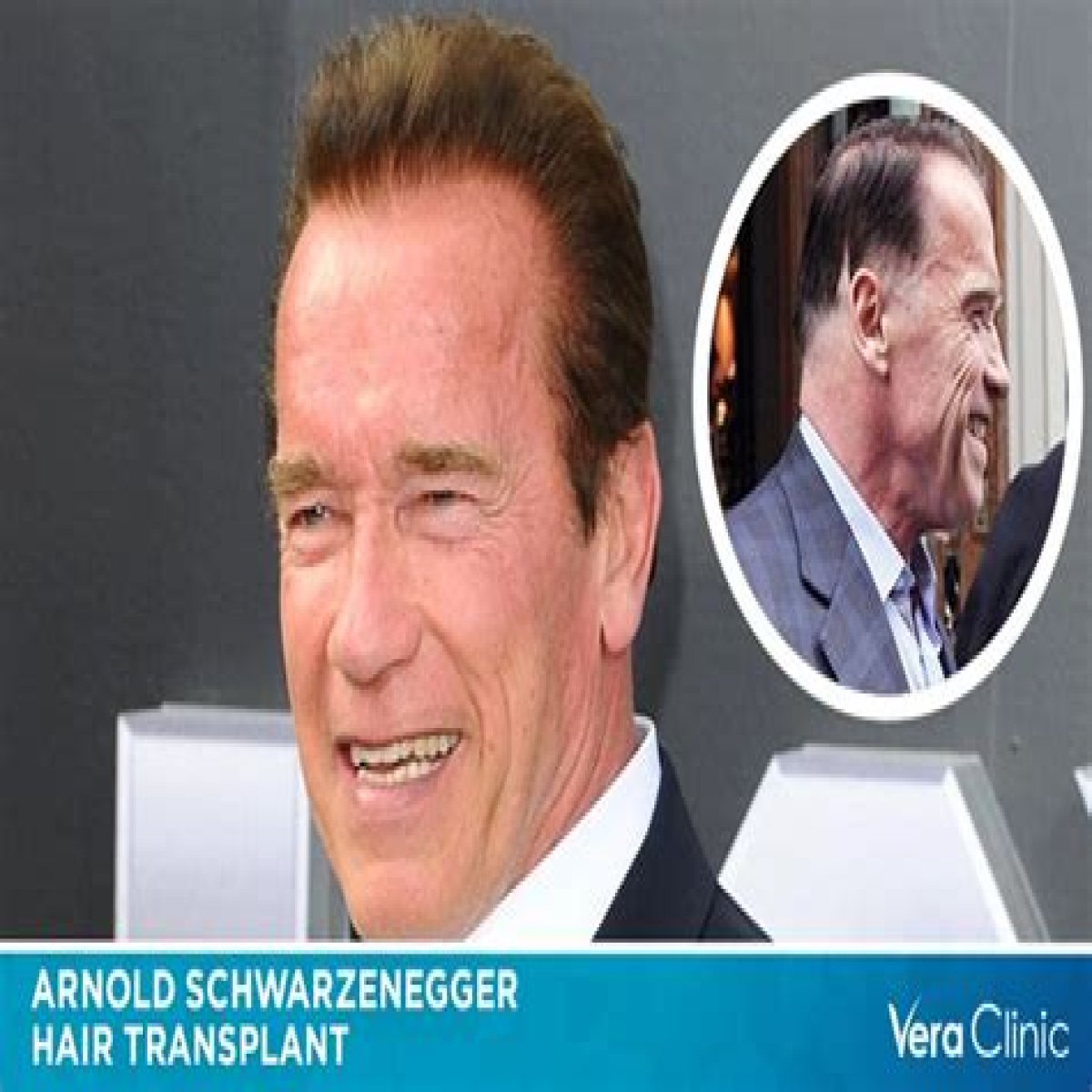Arnold Schwarzenegger's Remarkable Kidney Transplant Journey